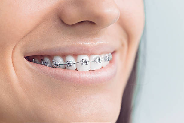 Best Wisdom Tooth Removal  in Bella Vista, CA